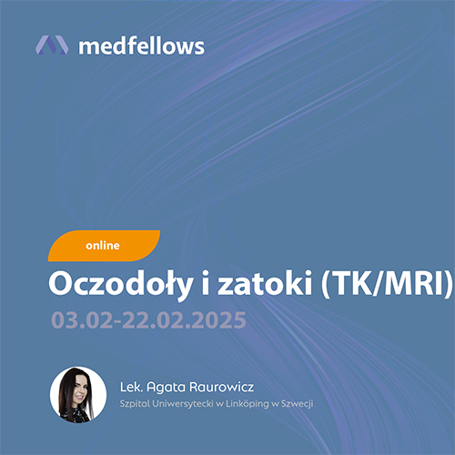 oczodoly i zatoki - raurowicz — up